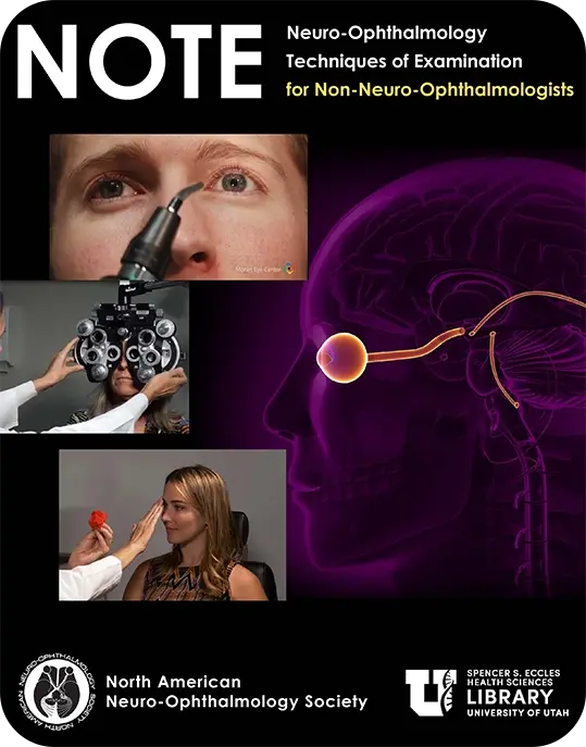 NANOS Note